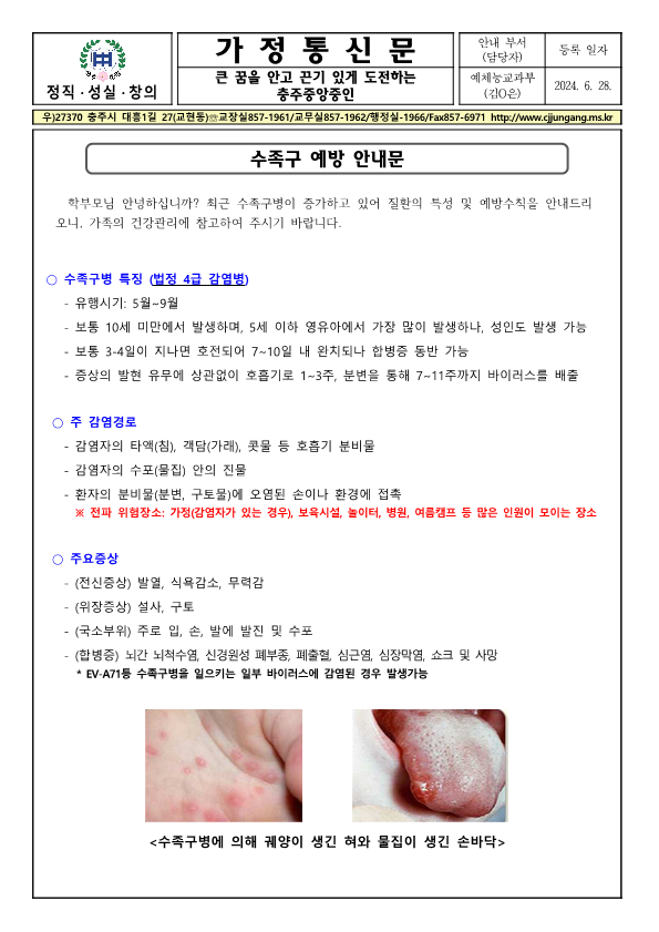 수족구 앞면